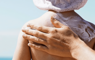 Myths about skin cancer